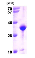 SDS-PAGE - Recombinant Human VAPA protein (His tag N-Terminus) (AB93462)