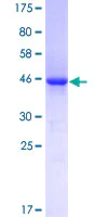 SDS-PAGE - Recombinant Human VASH1 protein (AB153190)