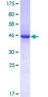 SDS-PAGE - Recombinant Human VASH1 protein (GST tag N-Terminus) (AB153190)