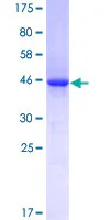 SDS-PAGE - Recombinant Human VASH1 protein (GST tag N-Terminus) (AB153190)