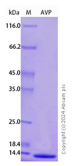 SDS-PAGE - Recombinant Human Vasopressin-neurophysin 2-copeptin Protein Standard (AB316550)