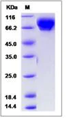 SDS-PAGE - Recombinant Human Vasorin protein (His tag) (AB276594)