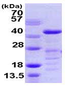 SDS-PAGE - Recombinant Human VASP protein (AB105601)