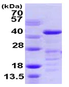 SDS-PAGE - Recombinant Human VASP protein (His tag N-Terminus) (AB105601)