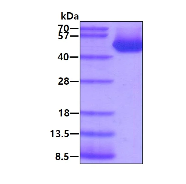 SDS-PAGE - Recombinant Human Vaspin protein (His tag N-Terminus) (AB86032)
