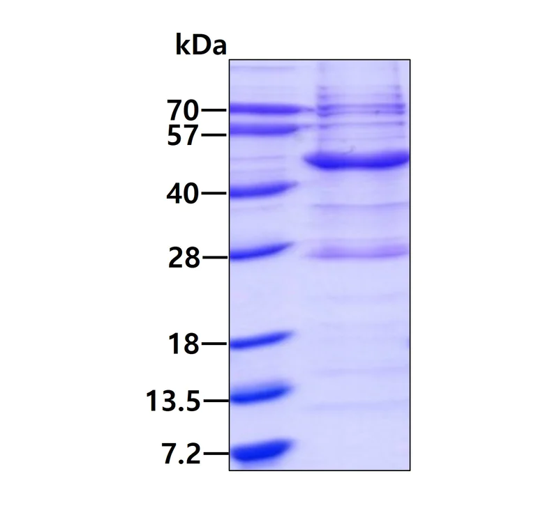 SDS-PAGE - Recombinant Human VAV1 protein (His tag N-Terminus) (AB176044)
