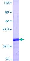 SDS-PAGE - Recombinant Human VAX1 protein (AB161249), expandable thumbnail