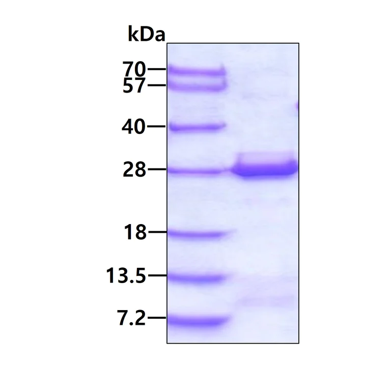 SDS-PAGE - Recombinant Human VBP-1 protein (AB139201)