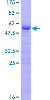 SDS-PAGE - Recombinant Human VCX-A protein (AB162570)