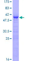 SDS-PAGE - Recombinant Human VCX-A protein (GST tag N-Terminus) (AB162570)