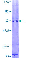 SDS-PAGE - Recombinant Human VDAC1/Porin protein (AB132481)
