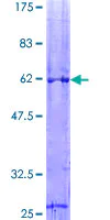 SDS-PAGE - Recombinant Human VDAC1/Porin protein (AB132481)