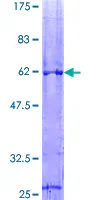 SDS-PAGE - Recombinant Human VDAC1/Porin protein (GST tag N-Terminus) (AB132481)