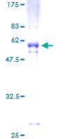SDS-PAGE - Recombinant Human VDAC2 protein (GST tag N-Terminus) (AB152793)