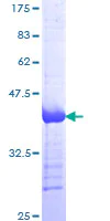 SDS-PAGE - Recombinant Human VE Cadherin protein (AB112269)