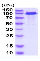 SDS-PAGE - Recombinant Human VE Cadherin protein (Fc Chimera His Tag) (AB224783), expandable thumbnail