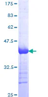SDS-PAGE - Recombinant Human VE Cadherin protein (GST tag N-Terminus) (AB112269)