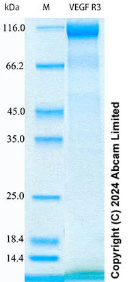 SDS-PAGE - Recombinant Human VEGF R3 Protein Standard (His tag) (AB322750)