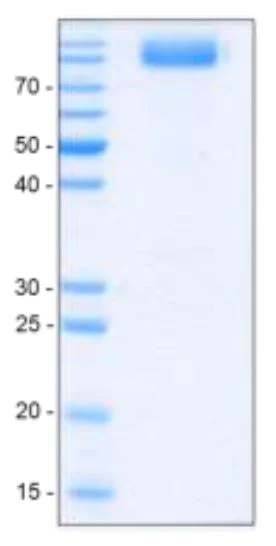 SDS-PAGE - Recombinant human VEGF Receptor 1 protein (AB54346)