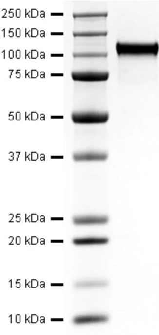 SDS-PAGE - Recombinant Human VEGF Receptor 1 protein (Active) (AB281824)