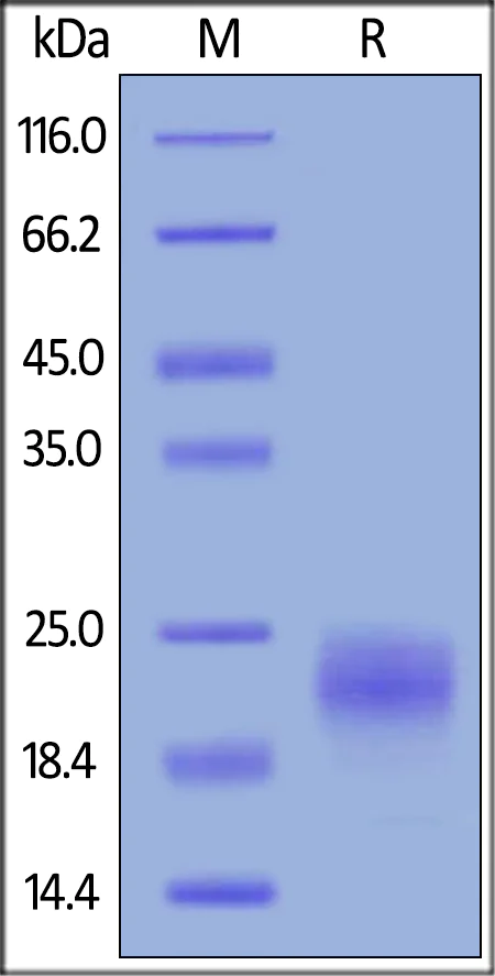 SDS-PAGE - Recombinant human VEGFC protein (AB155739)