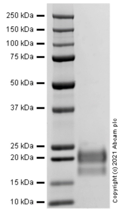 Recombinant Human VEGFC protein (Active)