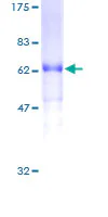 SDS-PAGE - Recombinant Human VEGFD protein (GST tag N-Terminus) (AB275916)