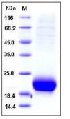 SDS-PAGE - Recombinant human VEGFD protein (His tag) (AB276294), expandable thumbnail