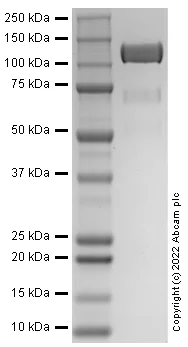 SDS-PAGE - Recombinant Human VEGFR3 Protein (AB290074)