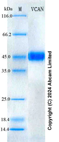 SDS-PAGE - Recombinant Human Versican Protein Standard (His tag) (AB322102)