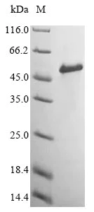 SDS-PAGE - Recombinant Human Versican protein (Tagged) (AB236178)