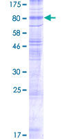 Recombinant Human VGluT1 protein