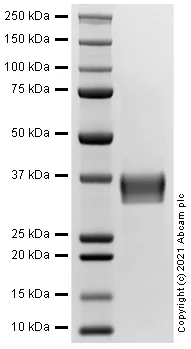SDS-PAGE - Recombinant Human VHL Protein (AB289731)