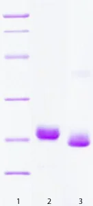 SDS-PAGE - Recombinant Human VILIP1 protein (AB63276)