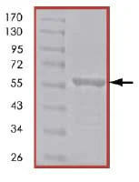 SDS-PAGE - Recombinant Human Vimentin protein (His tag N-Terminus) (AB84704)
