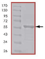 SDS-PAGE - Recombinant Human Vimentin protein (Tagged-His Tag) (AB84704), expandable thumbnail