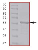 SDS-PAGE - Recombinant Human Vimentin protein (Tagged-His Tag) (AB84704)