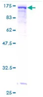 SDS-PAGE - Recombinant Human Vinculin protein (GST tag N-Terminus) (AB131747)