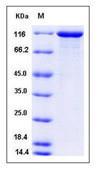 SDS-PAGE - Recombinant Human Vinculin protein (His tag) (AB276192), expandable thumbnail