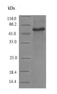 SDS-PAGE - Recombinant Human Vinculin protein (Tagged) (AB238349), expandable thumbnail