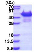 SDS-PAGE - Recombinant Human Vinexin protein (AB177680), expandable thumbnail