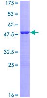 SDS-PAGE - Recombinant Human VIP protein (AB112371)