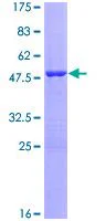SDS-PAGE - Recombinant Human VIP protein (GST tag N-Terminus) (AB112371)