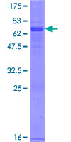 SDS-PAGE - Recombinant Human VISTA protein (AB163782), expandable thumbnail