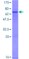 SDS-PAGE - Recombinant Human VISTA protein (AB163782)