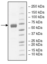 SDS-PAGE - Recombinant Human VISTA protein (Fc tag C-Terminus) (AB198480)