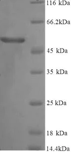 SDS-PAGE - Recombinant Human Vitamin D Binding protein (Tagged) (AB240843)