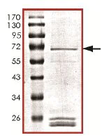 SDS-PAGE - Recombinant Human VLK protein (AB131683)
