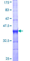 SDS-PAGE - Recombinant Human VMAT2 protein (AB112353), expandable thumbnail