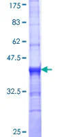 SDS-PAGE - Recombinant Human VMAT2 protein (AB112353)